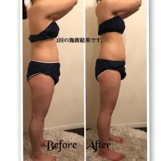 FLEUR大阪・美容 整体・痩身・小顔のエステ・リラクイメージ