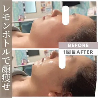小顔矯正専門店 ❤️池田 桃花のエステ・リラクイメージ