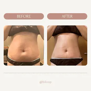 biloop所属・《痩身×疲労改善》 BILOOPのエステ・リラクイメージ