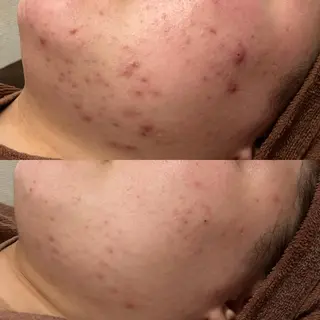 来春までに脱・肌荒れ できるサロン✨のエステ・リラクイメージ