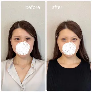 美容鍼×小顔×姿勢× ブライダル整体のエステ・リラクイメージ