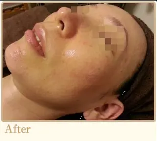 ピーリングサロン シャンテール所属・ピーリングサロン シャンテールのエステ・リラクイメージ