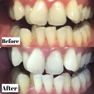 LBS吉祥寺 公式のエステ・リラクイメージ