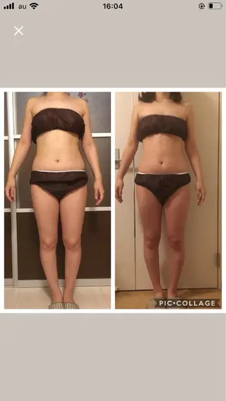 マツエク・マツパ アニメ,Vオタク× 即効痩せエステサロンのエステ・リラクイメージ