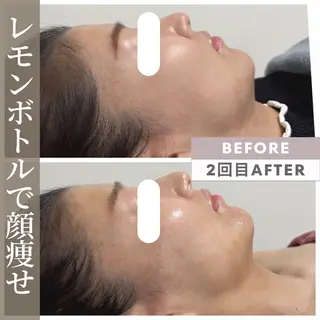 小顔矯正専門店 ❤️池田 桃花のエステ・リラクイメージ