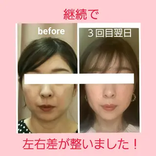 小顔と美肌 まごころエステMatoria所属・小顔 美肌専門 Matoriaのエステ・リラクイメージ