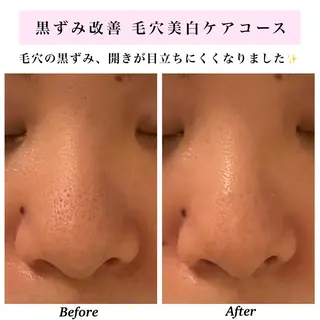 Bellesthe (ベルエステ)のエステ・リラクイメージ