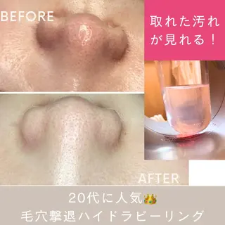 肌質改善エステ chiffonのエステ・リラクイメージ