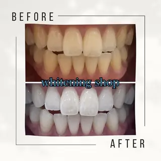 メンズ ホワイトニング ショップ千葉店のその他イメージ