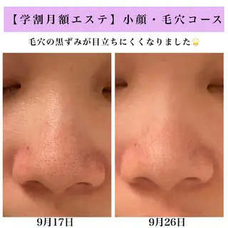 Bellesthe (ベルエステ)のエステ・リラクイメージ