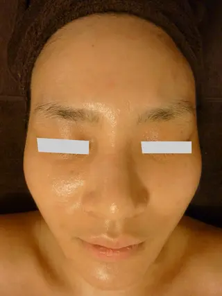 ピーリングサロン シャンテール所属・ピーリングサロン シャンテールのエステ・リラクイメージ