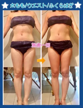 ショート カラー パーマ ヘアアレンジ メンズ キッズ ネイル マツエク・マツパ 痩身&ボディ 結果出し🌟丹野のエステ・リラクイメージ