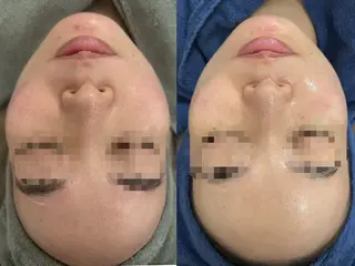 PERSONAL BEAUTY🪻のエステ・リラクイメージ