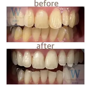 ホワイトニング ショップ船橋店のエステ・リラクイメージ