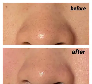 DeI'm   名古屋栄所属・小林 玲菜のエステ・リラクイメージ