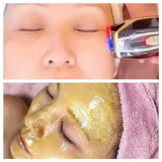 肌質改善エステ chiffonのエステ・リラクイメージ