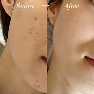 肌質改善サロン🌕 ⠀【ルーナピエナ】のエステ・リラクイメージ