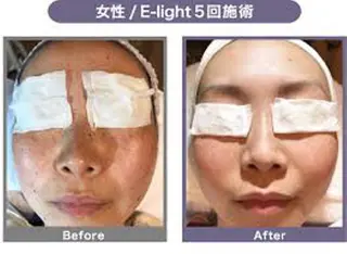 salon Sunny所属・脱毛salon Sunnyのエステ・リラクイメージ