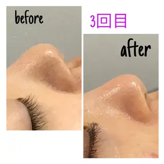 アルカンジュ~archange~所属・痩身/毛穴洗浄/脱毛 アルカンジュのエステ・リラクイメージ