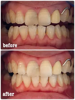 ホワイトニングサロン ラウレアのその他イメージ