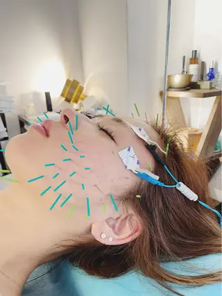 小顔美容鍼専門サロン 渋谷YZのエステ・リラクイメージ