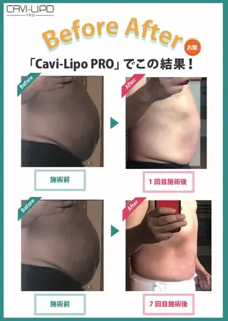 エステサロン JURISのエステ・リラクイメージ