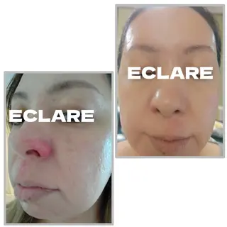 グリーンピール専門店 ECLAREのエステ・リラクイメージ