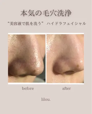 吉田 lilou.のエステ・リラクイメージ