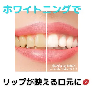 ホワイトニングショップ桜木町店所属・ホワイトニング ショップ桜木町店のエステ・リラクイメージ