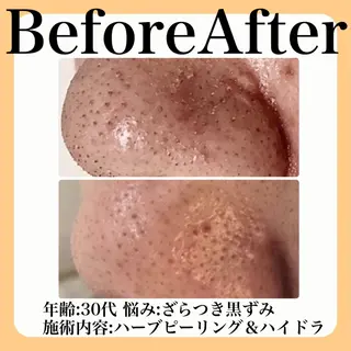 毛穴・たるみ･ニキビケア専門サロンsui所属・sui【スイ】 ARISAのエステ・リラクイメージ