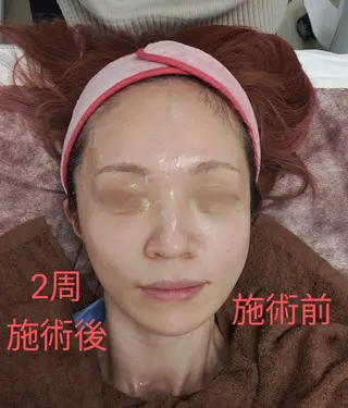 ナスサロ️ 看護師️🫧山口のエステ・リラクイメージ