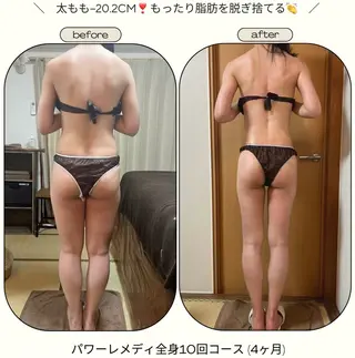 biloop所属・《痩身×疲労改善》 BILOOPのエステ・リラクイメージ