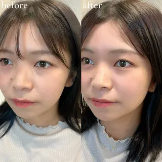 マツエク・マツパ TREE 筒井紫歩のマツエク・マツパデザイン