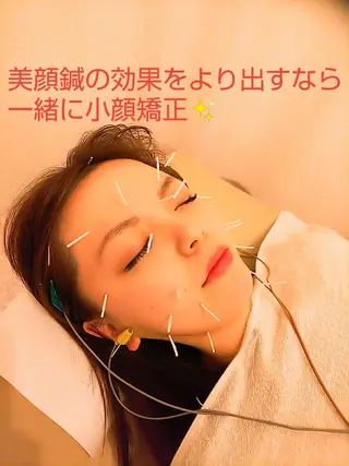 むくみたるみ専門☆ 美容鍼・小顔矯正のエステ・リラクイメージ
