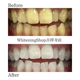ホワイトニング専門店 御殿山/吉祥寺店のその他イメージ