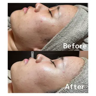 NiU.BEAUTY 新宿のエステ・リラクイメージ