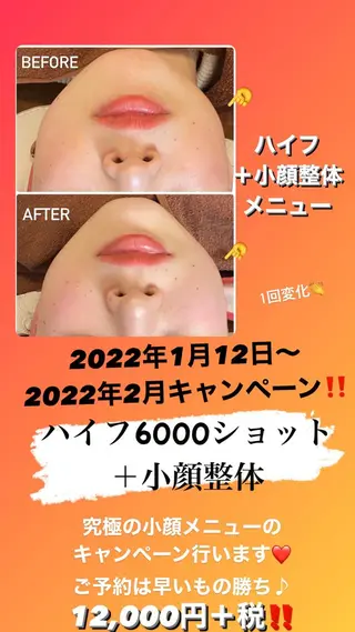 FLEUR大阪・整体 ・ハイフ・痩身・小顔のエステ・リラクイメージ