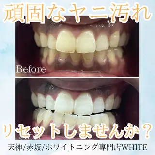メンズ ホワイトニング専門店 WHITE天神店のエステ・リラクイメージ