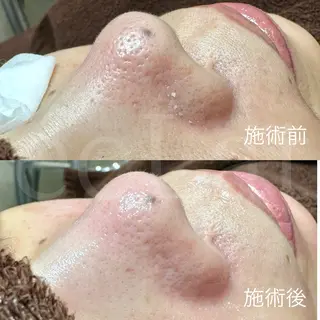 岩本 麻那のマツエク・マツパデザイン