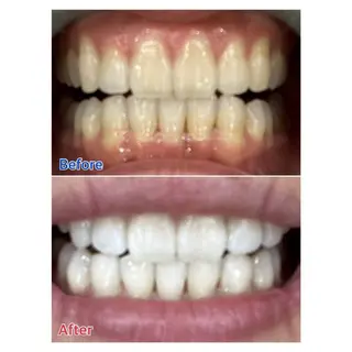 MBEAUTYSALON 千葉店・京成大久保所属・Melty 輝のその他イメージ