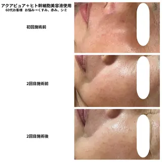 Linoa所属・Linoa（リノア） エステ&リラクのエステ・リラクイメージ