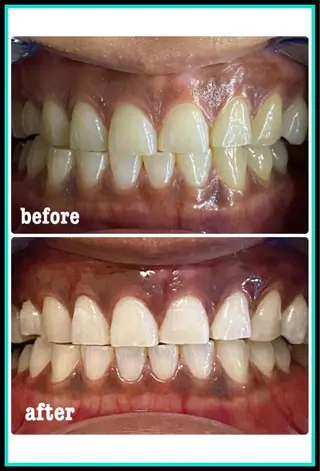 ホワイトニングサロン ラウレアのその他イメージ