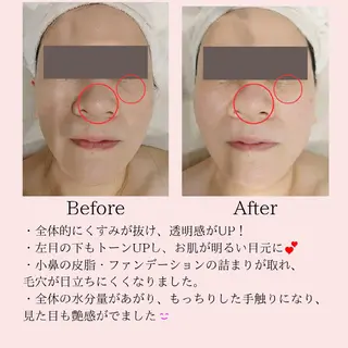 PRETTIEST SHINE所属・山田 浩子のエステ・リラクイメージ