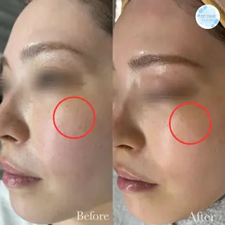 美容鍼脱毛salon リノン吹田駅前店のその他イメージ