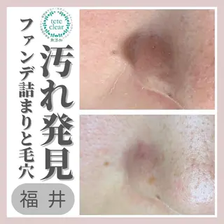 毛穴ケア専門サロン Yourmeユアミーのエステ・リラクイメージ