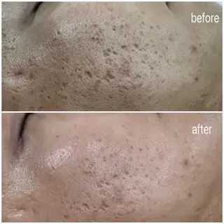 skinity所属・ピーリング専門サロン skinityのエステ・リラクイメージ