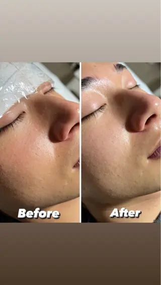 脱毛＆Beauty salon IILA所属・肌管理/HBL専門店 Sakuraの眉毛・アイブロウイメージ
