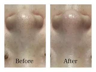 Purnama(ﾌﾟﾙﾅﾓ)所属・Purnama あきのネイルデザイン