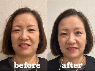美容鍼灸Solana所属・小櫻 唯のエステ・リラクイメージ