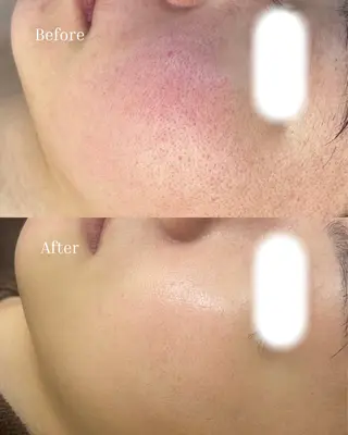 BELLIS HUIT所属・体質｜肌質改善ꕤ BELLISHUITのその他イメージ